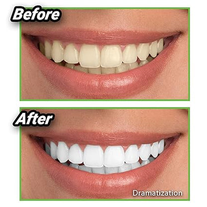Blanqueador dental en Polvo Miracle Teeth Whitener